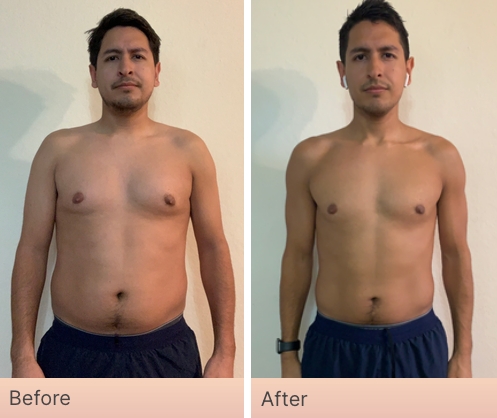 Before and After Real Result pictures of a person who has used the NeoraFit System - 4